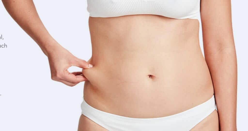 CoolSculpting Treatment | Sheperd Integrative Dermatology in Mount Pleasant, SC