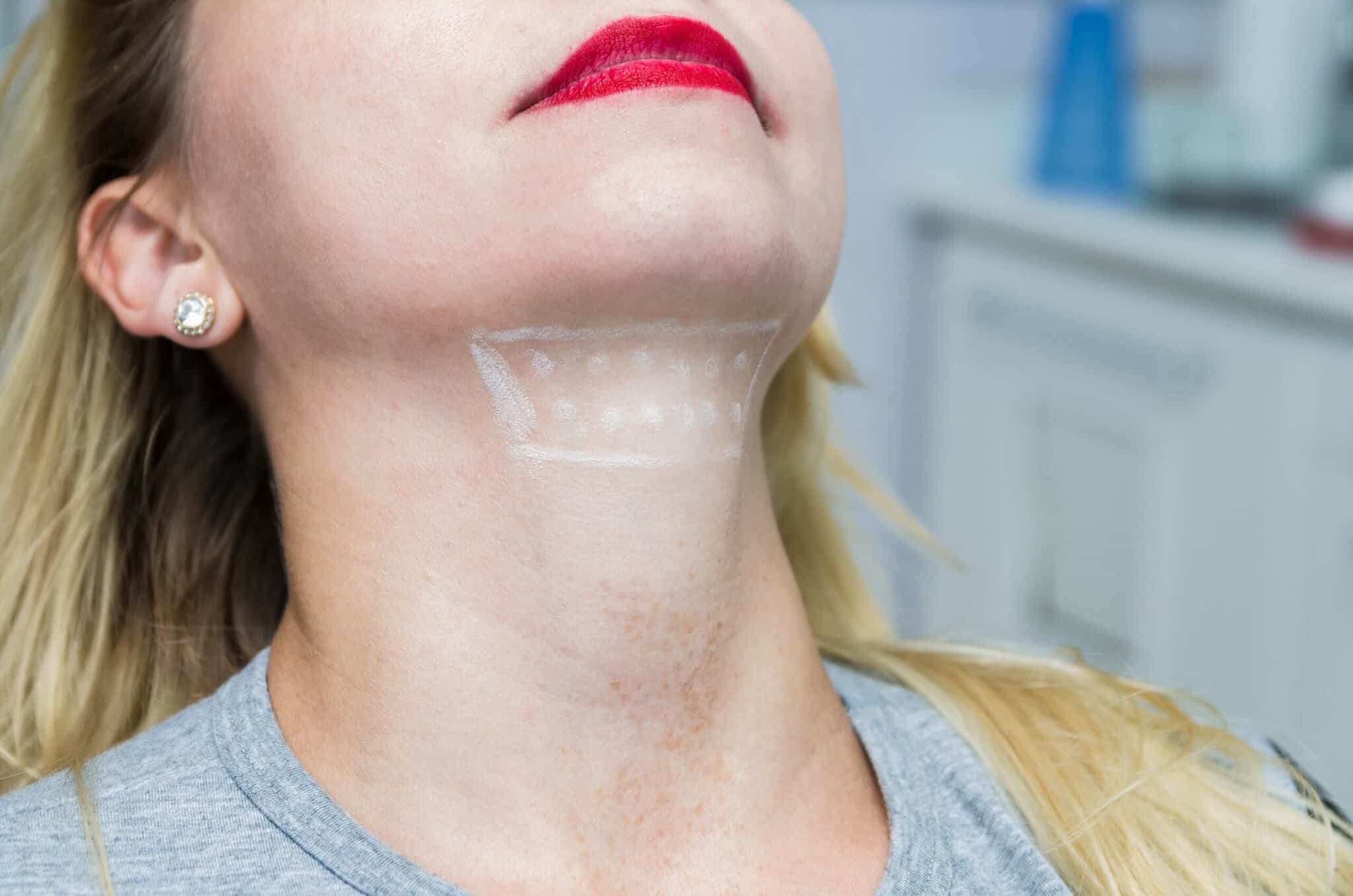 An Overview Of KYBELLA treatment What It Is And How It Works
