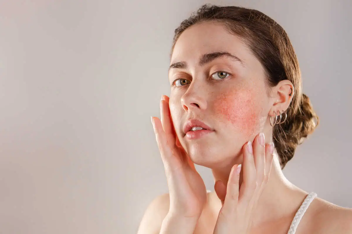 Dermatological Treatments by Sheperd Integrative Dermatology in Mount Pleasant SC