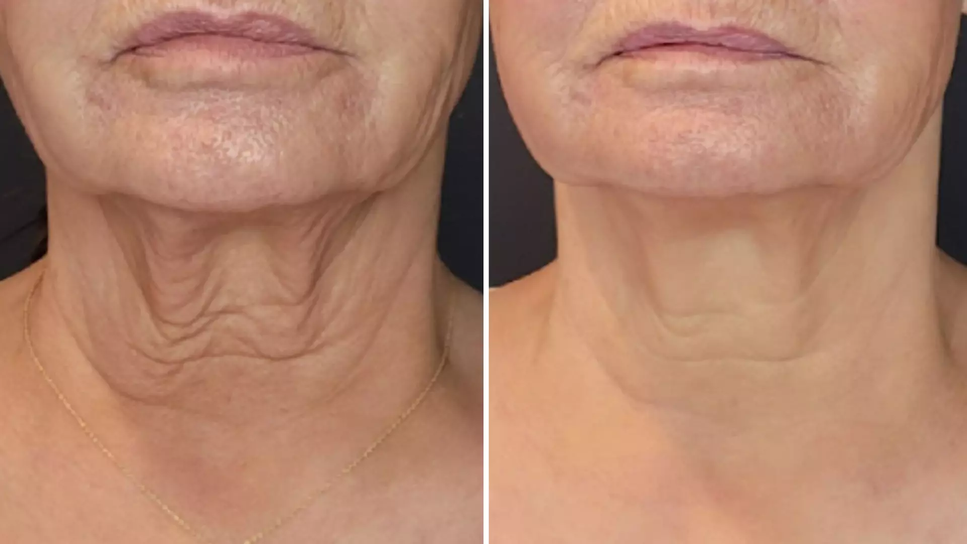 a collage of a woman's neck and neck before and after