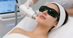 laser treatment in Mount Pleasant, SC