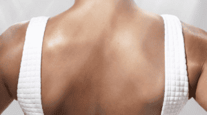 Woman Back Side Image | Sheperd Integrative Dermatology in Mount Pleasant, SC