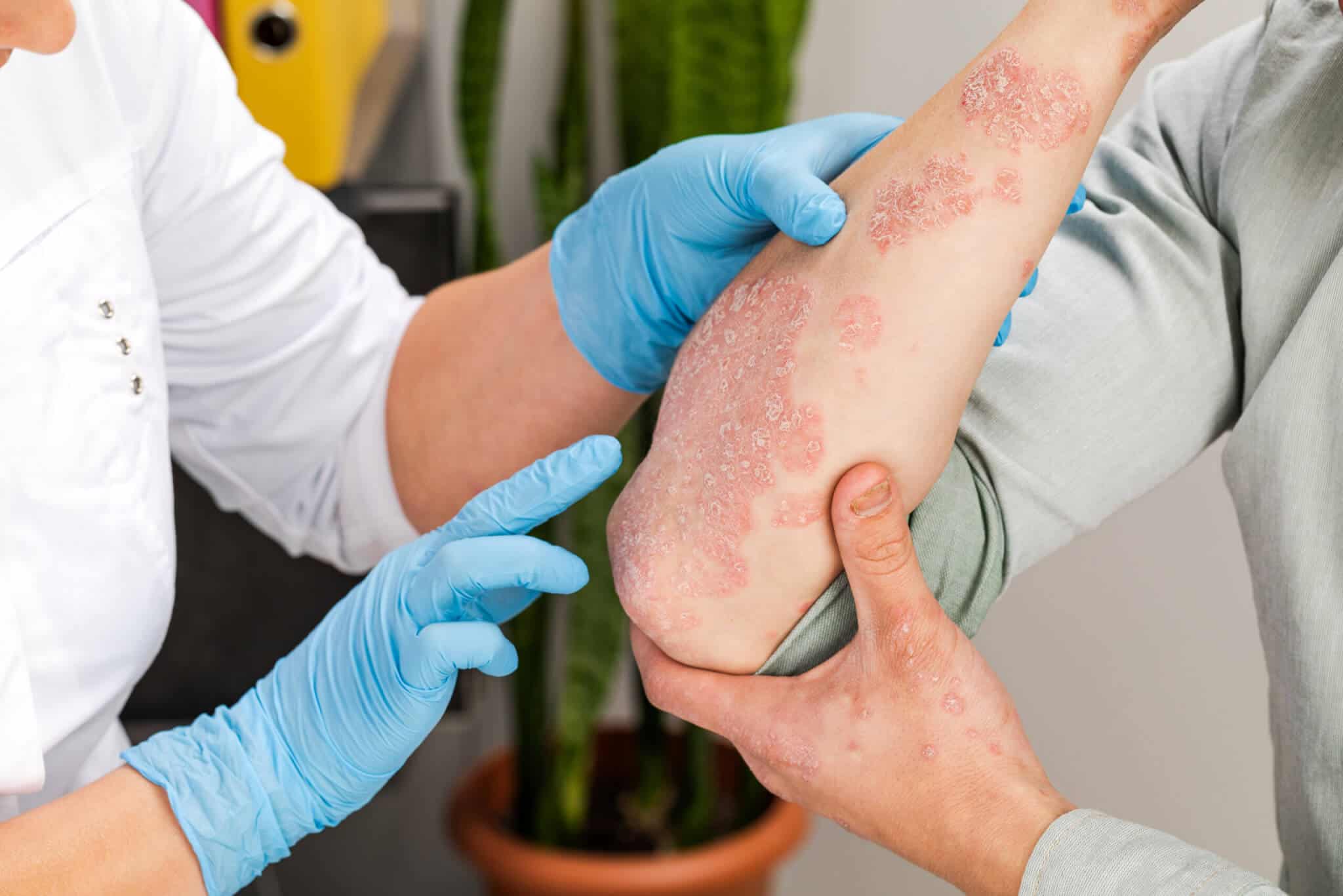 Unveiling Dermatological Conditions Understanding and Managing Common Skin Disorders